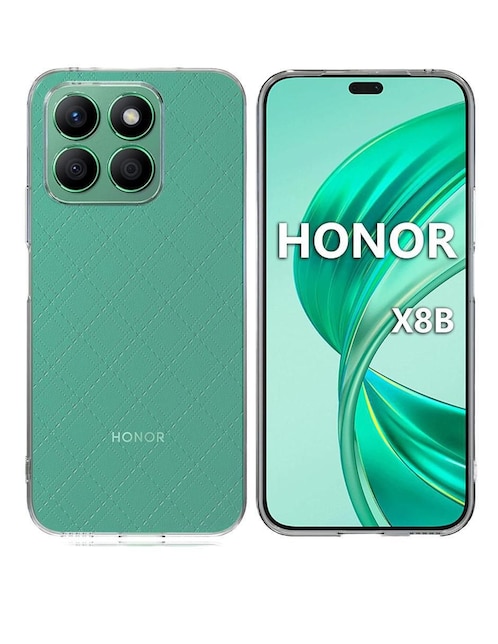 KIOSLA Funda para HONOR X8B de TPU